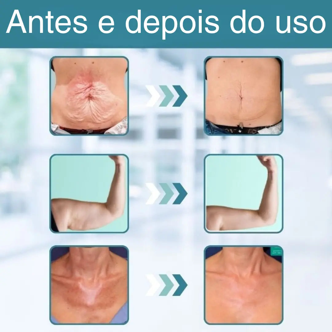 Glow Essência™ | Firma a pele flácida em 97% em apenas 24 horas!