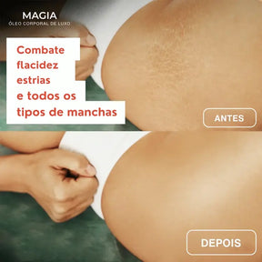 Glow Essência™ | Firma a pele flácida em 97% em apenas 24 horas!