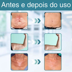 Glow Essência™ | Firma a pele flácida em 97% em apenas 24 horas!