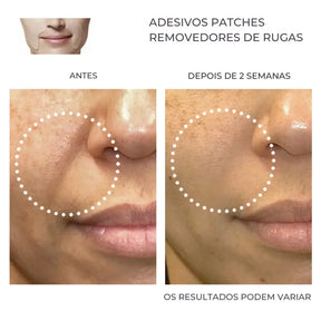 Adesivos faciais reutilizáveis antirrugas - 16 unidades