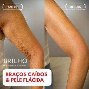 Óleo Corporal Mágico™ Beladermy - 100ml