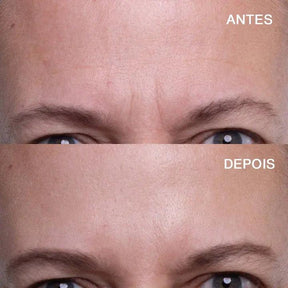 Adesivo para testa antirrugas